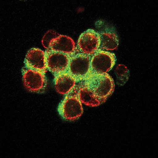 Spheroid of ovarian cancer cells growing in 3D
Photo Credit: Jaidev Bapat